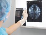 technician-reviewing-breast-mammogram-image