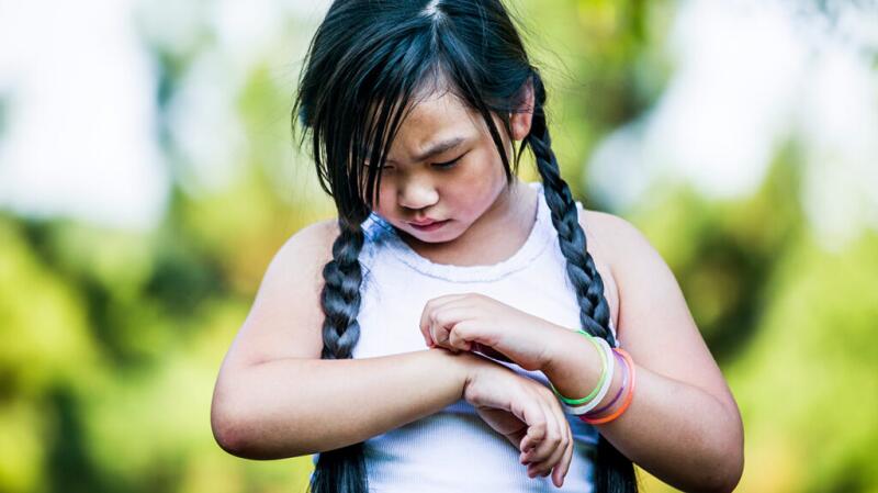 school-age girl of East Asian descent looking down at her arm and scratching it