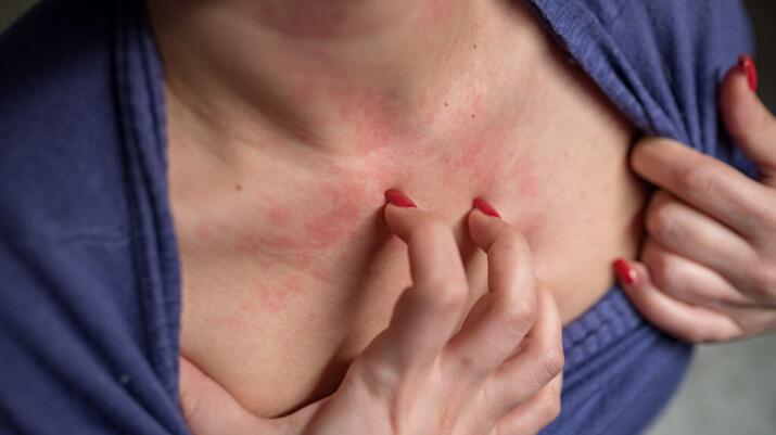 Women scratch the itch with hand