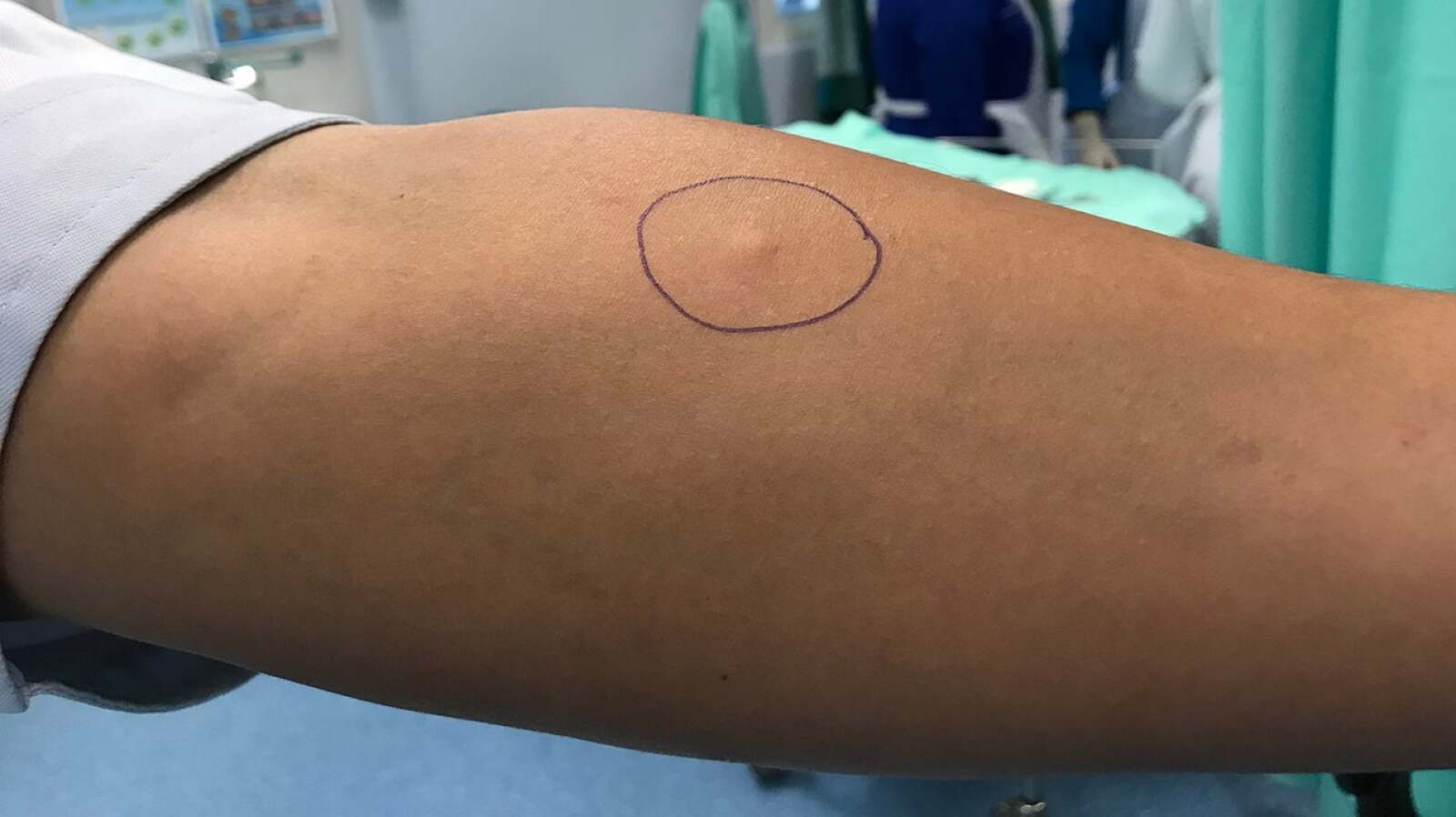 Tuberculosis Test Methods, Results, Risks, and More