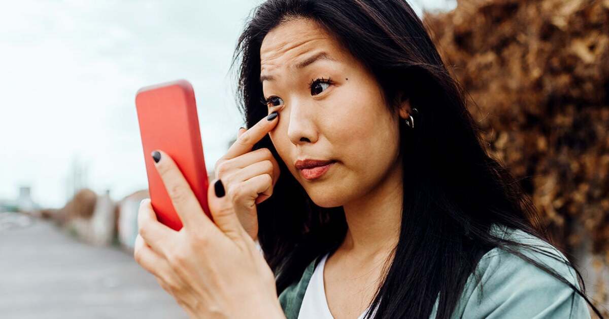 Internal Stye: Causes, Symptoms, Treatments, and Outlook