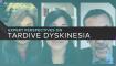 expert-perspectives-on-tardive-dyskinesia