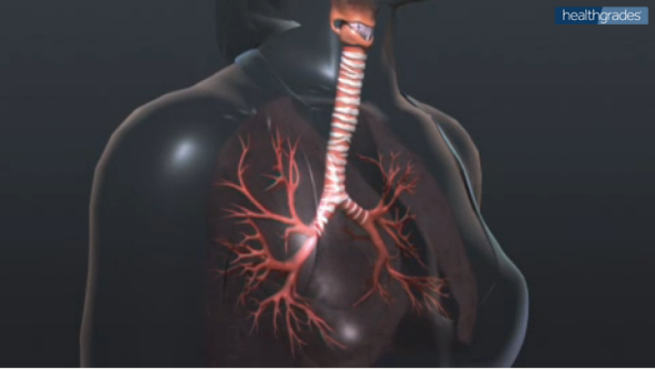 COPD Interactive Body Map Video