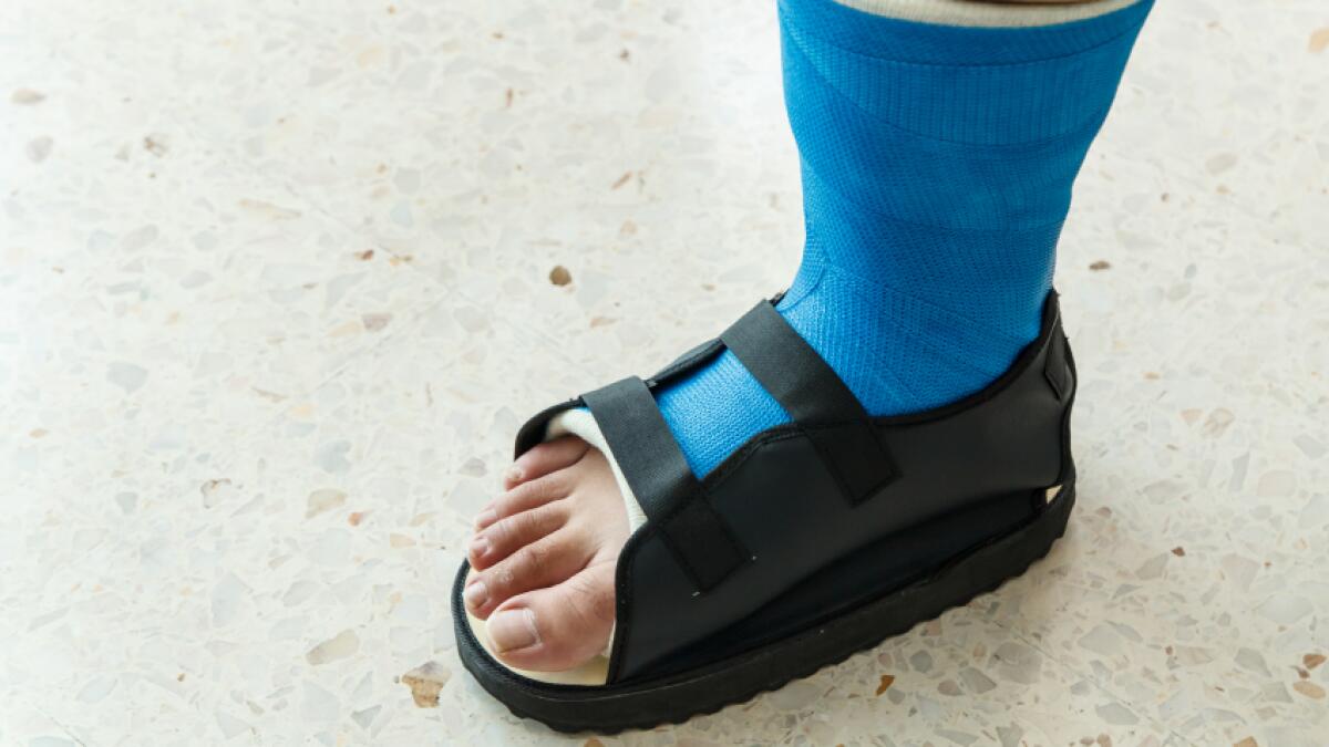 7 Tips for Recovering from a Broken or Dislocated Foot