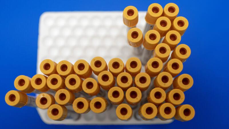 there are yellow blood tubes in a grid that look a little like white blood cells