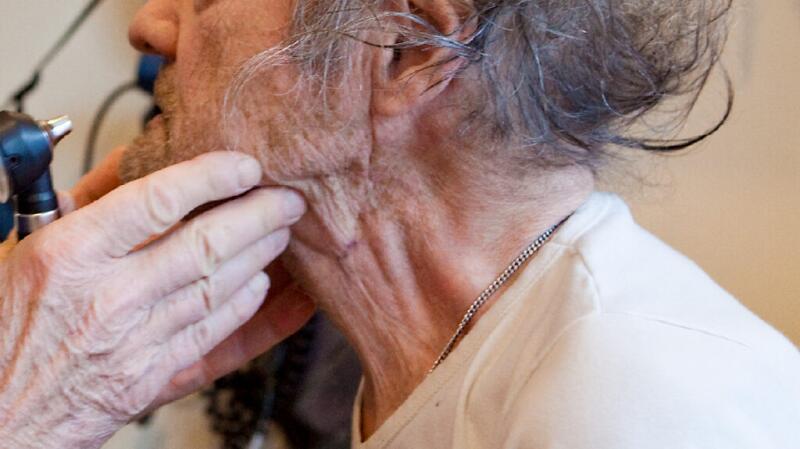 swollen lymph node, or lymphadenopathy