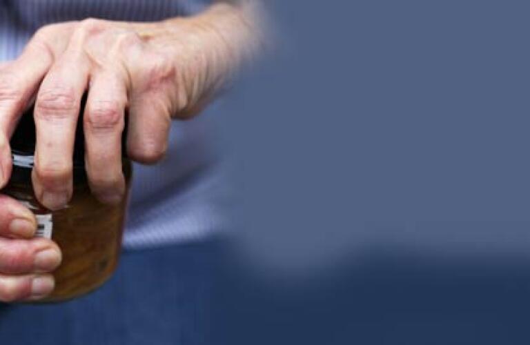 arthritis-SL-symptoms-diagnosis