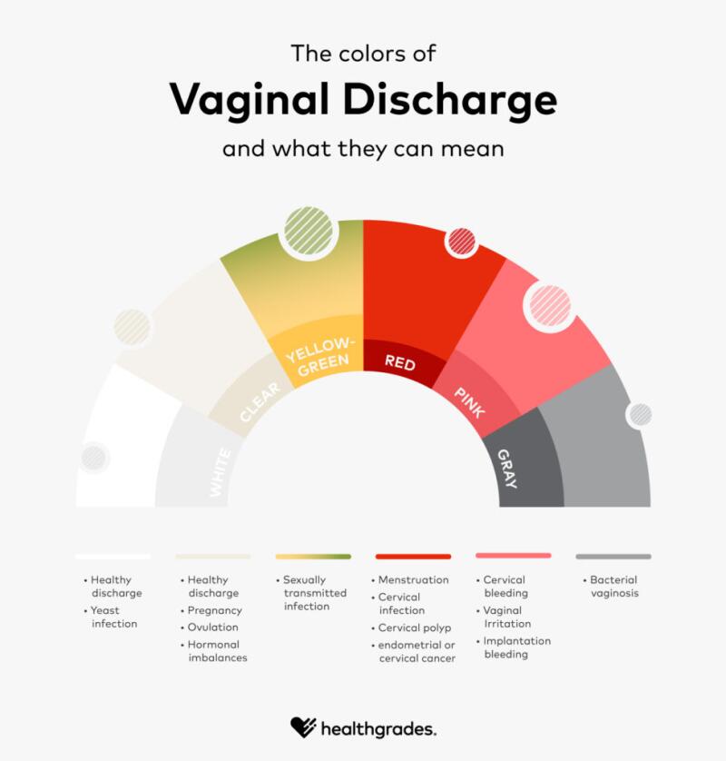 Vaginal Discharge: What's Normal? Brown Discharge, Yellow Discharge, White  Discharge & More