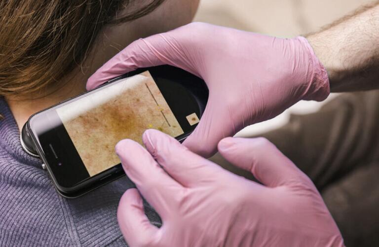gloved hands holding magnifying camera to examine woman's skin on shoulder and neck area