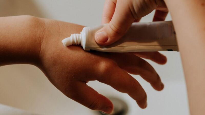 Hives: Symptoms, Treatment Steps, and When to Get Help Hives: Symptoms, Treatment Steps, and When to Get Help