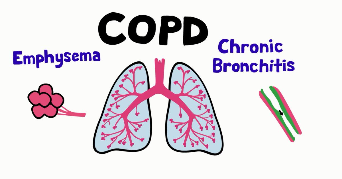 COPD Treatment Options