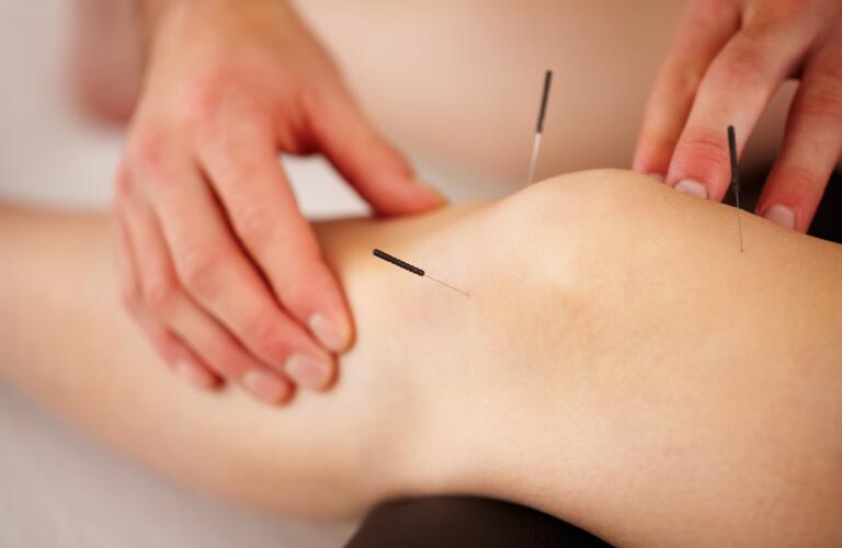 acupuncture-on-knee