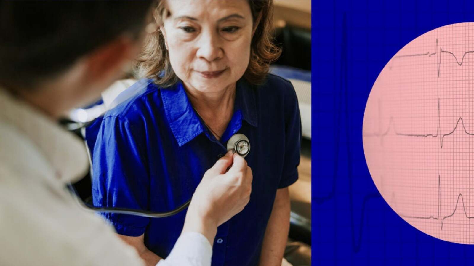 High Output Heart Failure: Symptoms, Causes, and Treatment