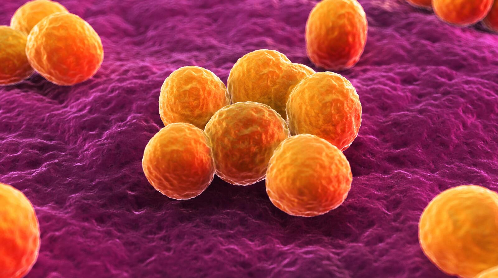 Staph Infection Symptoms, Causes & Treatment Staphylococcus aureus