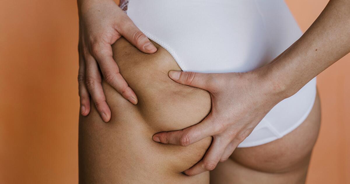 Boils on Your Buttocks: Causes, Treatment, Prevention, and More