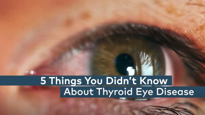 Graves' Disease vs. Hashimoto Thyroiditis: How To Tell Them Apart