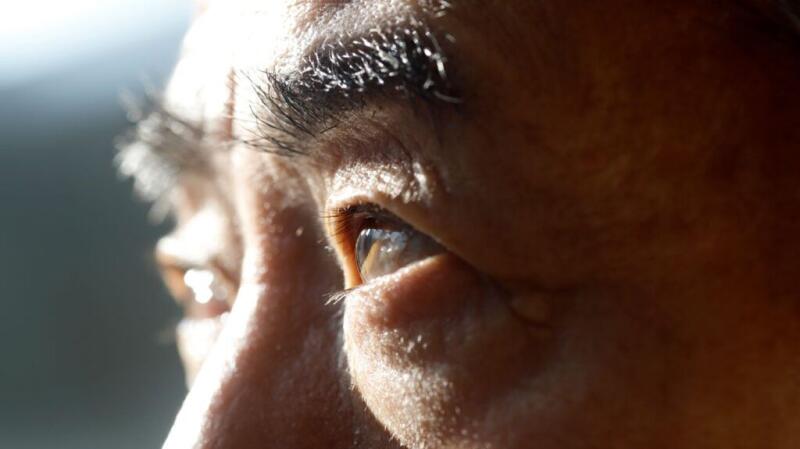 A closeup of someones open eyes in the direct sun.