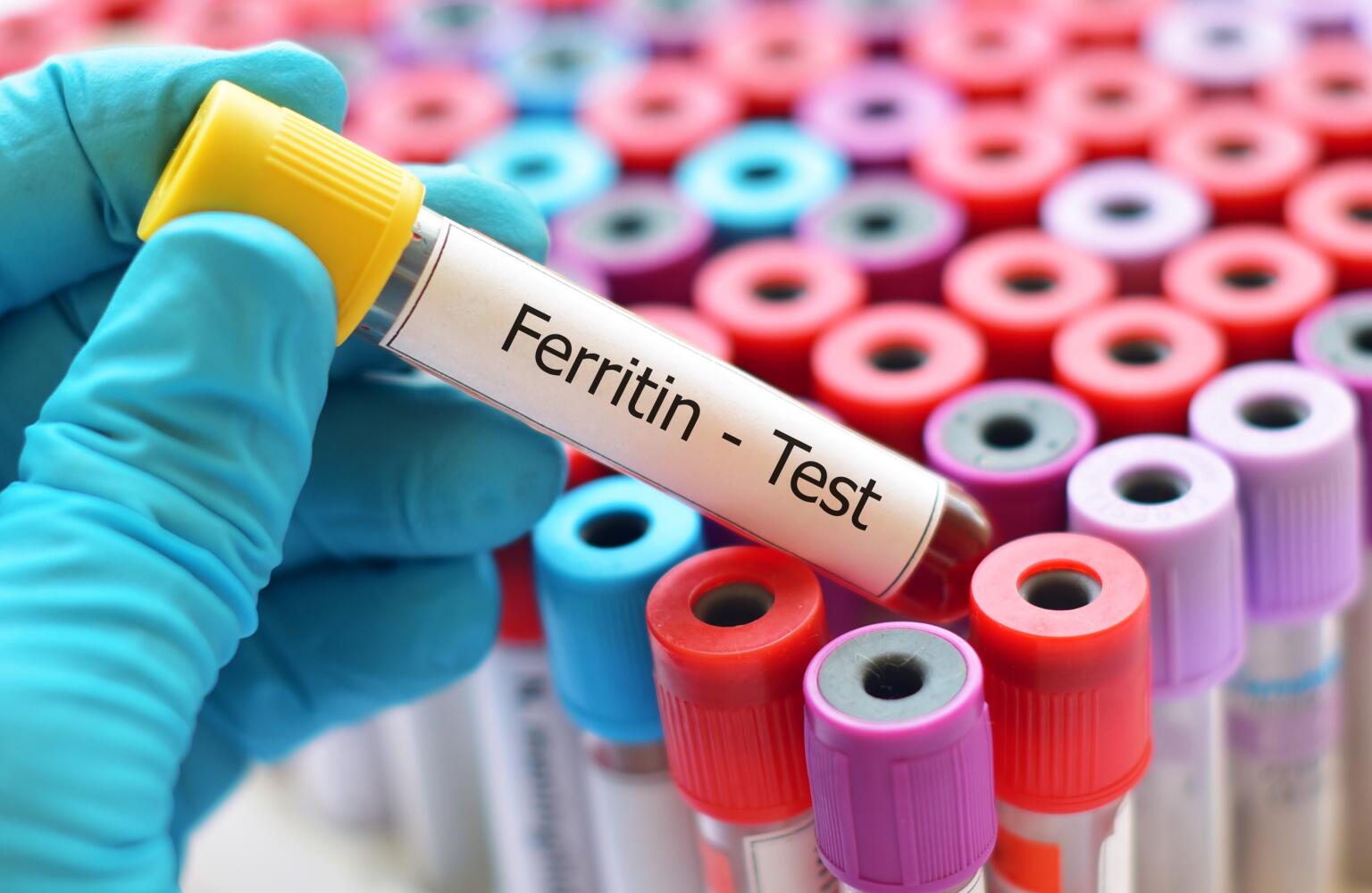 Iron Blood Test 6 Reasons To Test Your Iron Level iron-blood-test-6-reasons-to-test-your-iron-level