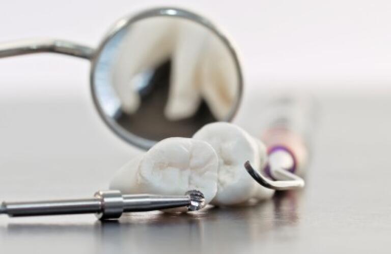 Wisdom Tooth Extraction
