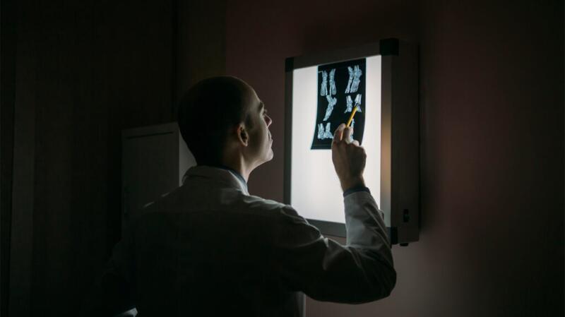 a man is looking at an X ray