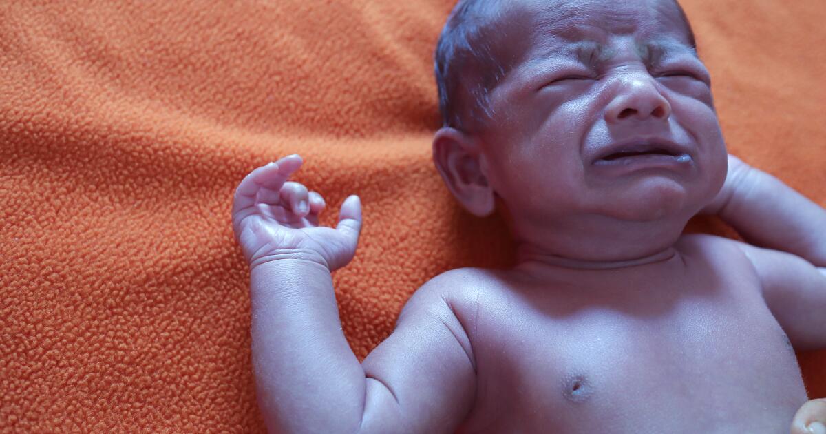 Cyanosis Definition Causes Central Peripheral Cyanosis