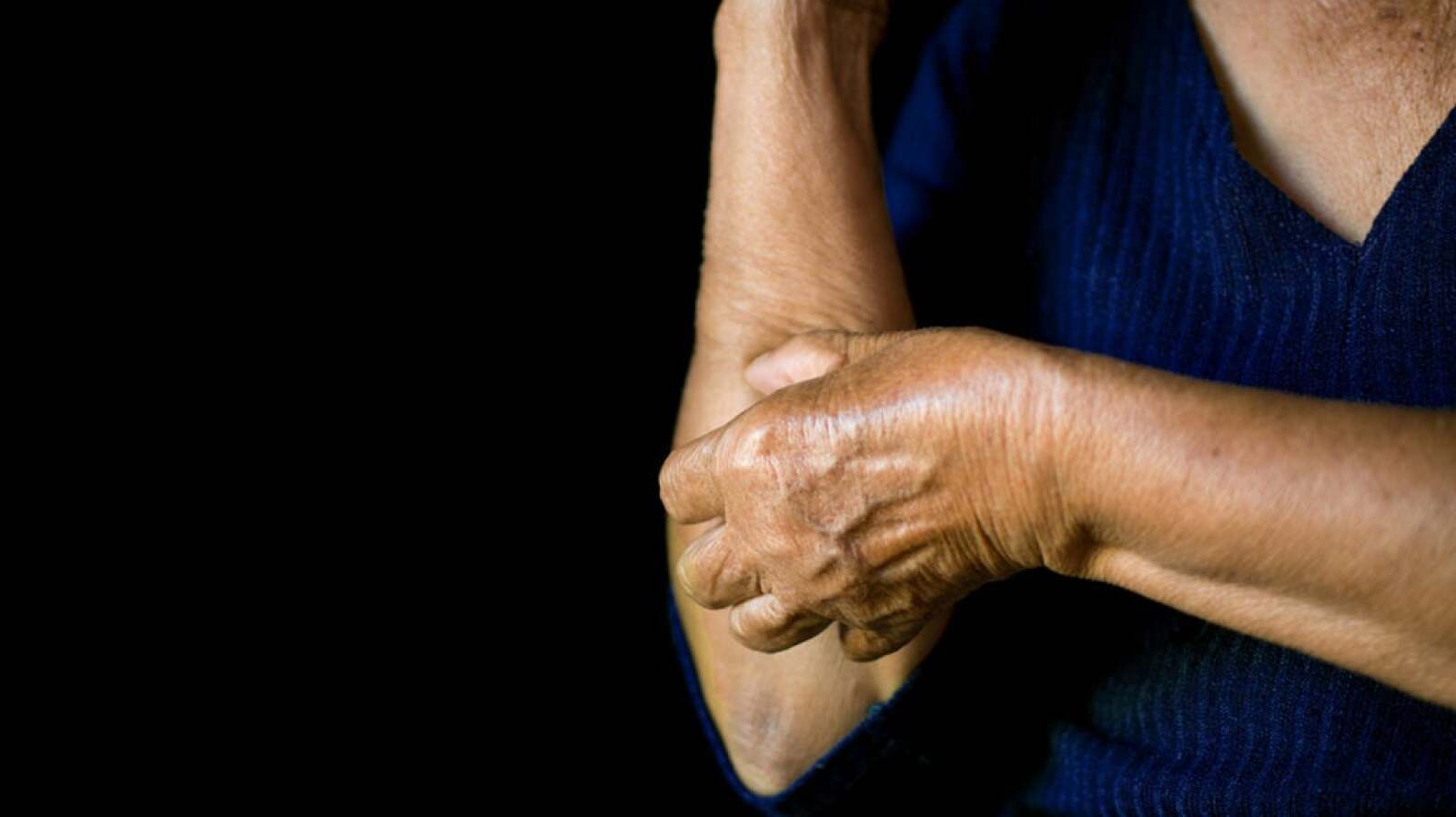 HIV Rash: Appearance, Pictures, Treatments