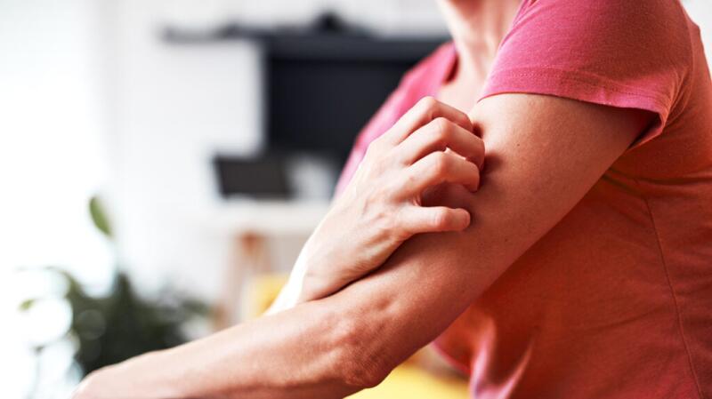 person scratching their arm