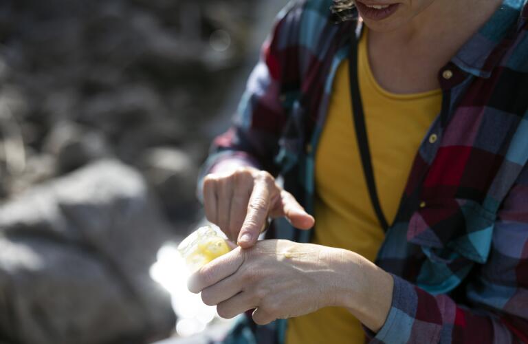 Close-up of Adult Woman applying bug Bite Balm Into Her Hands Outdoors 