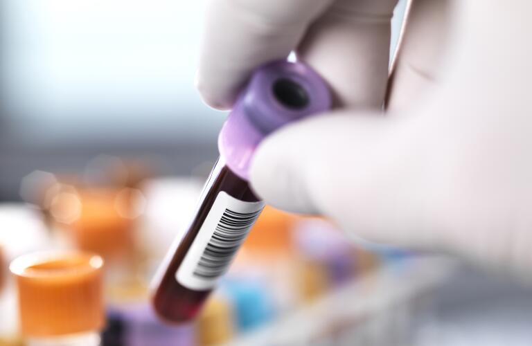 Unseen lab technician placing blood test vial in basket
