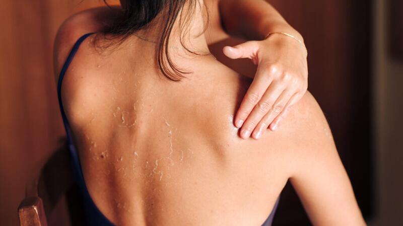 Instant Sunburn Relief & Cure, Cure a Sunburn