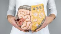 Good News About Difficult Colon Polyps