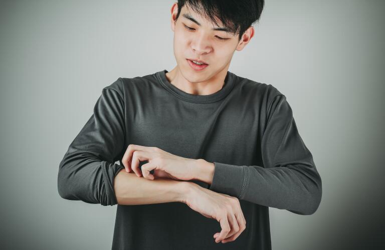 young man scratching skin on arm