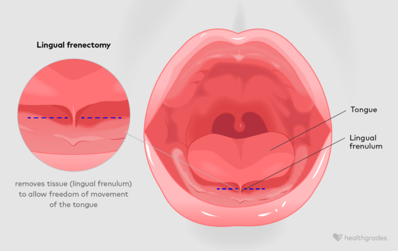 Medical illustration of frenulum