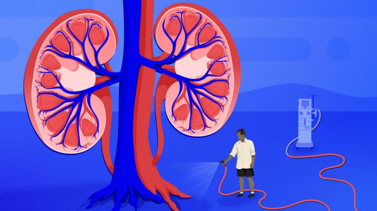 Stage 5 Kidney Disease Life Expectancy And More stage-5-kidney-disease-life-expectancy-and-more