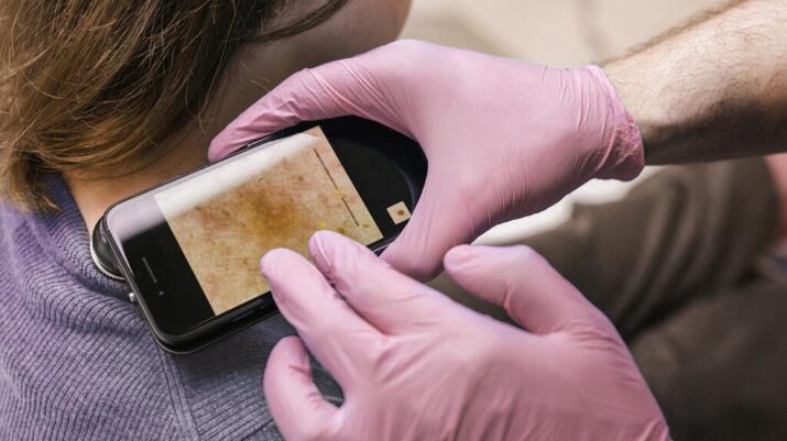 gloved hands holding magnifying camera to examine woman's skin on shoulder and neck area