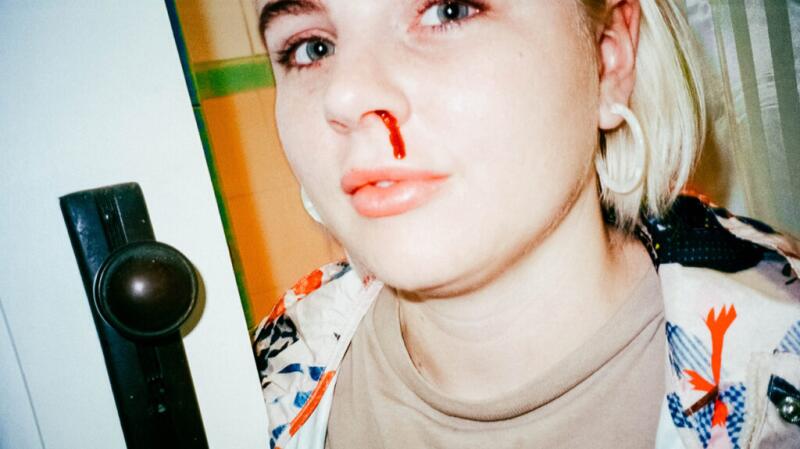 Young female with bloody nose