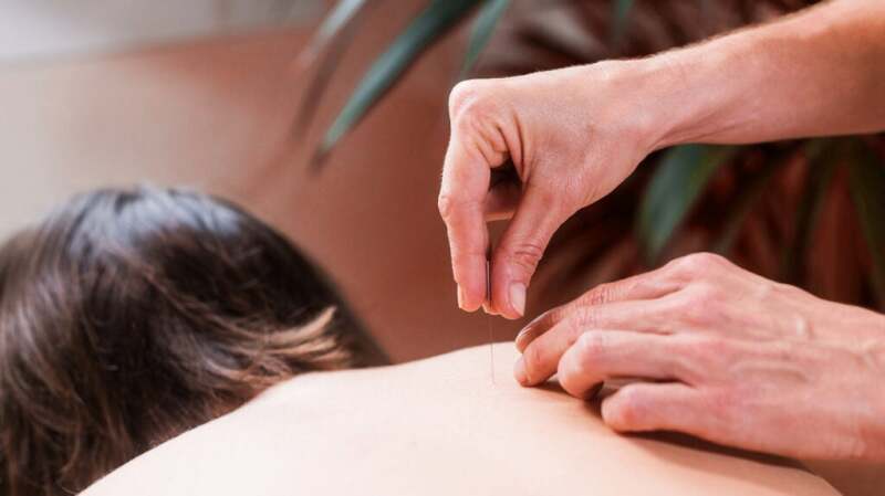 Acupuncture for Back Pain: Effectiveness, Risks, and More