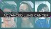 patient-voices-advanced-lung-cancer