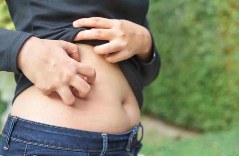 Midsection Of Woman Scratching Stomach Outdoors