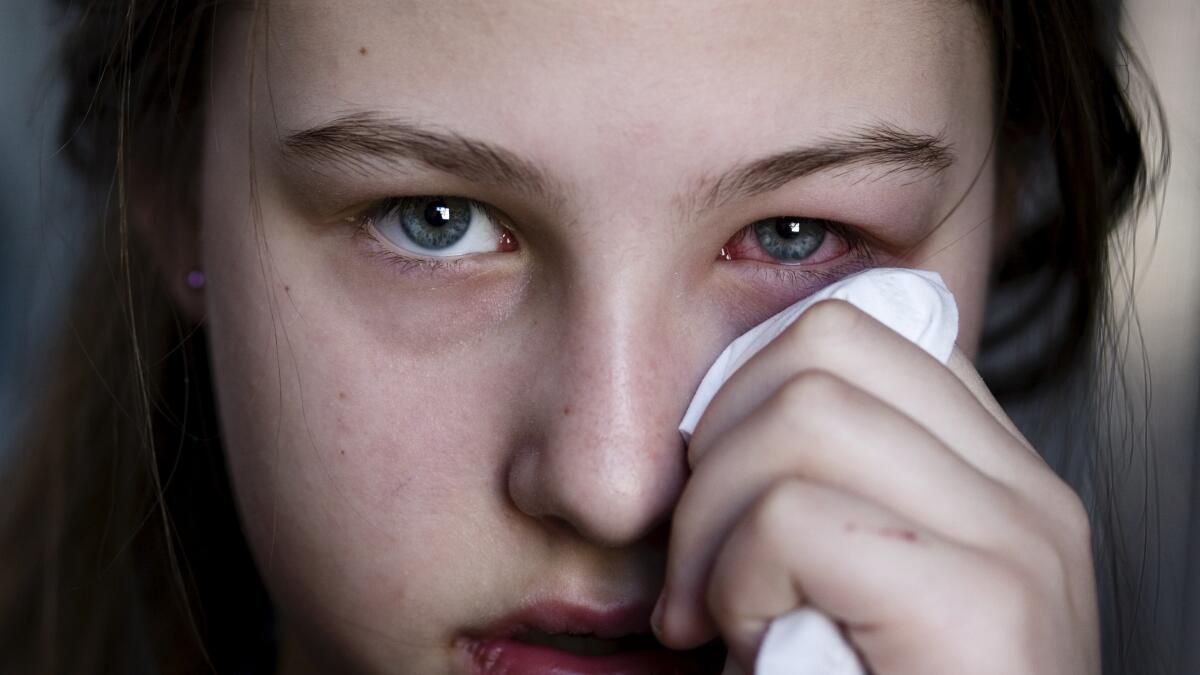 Eye Infection - Symptoms, Causes, Treatments