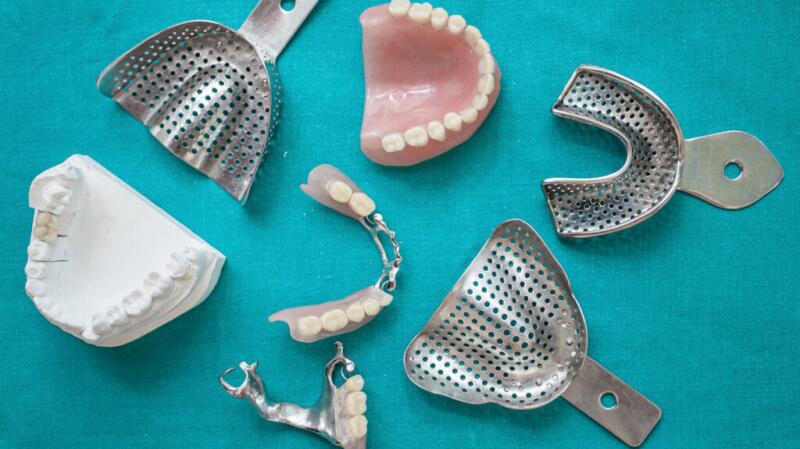 picture of molds and casts of teeth alongside dentures
