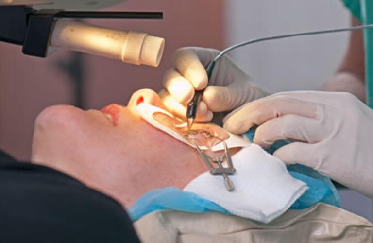 LASIK