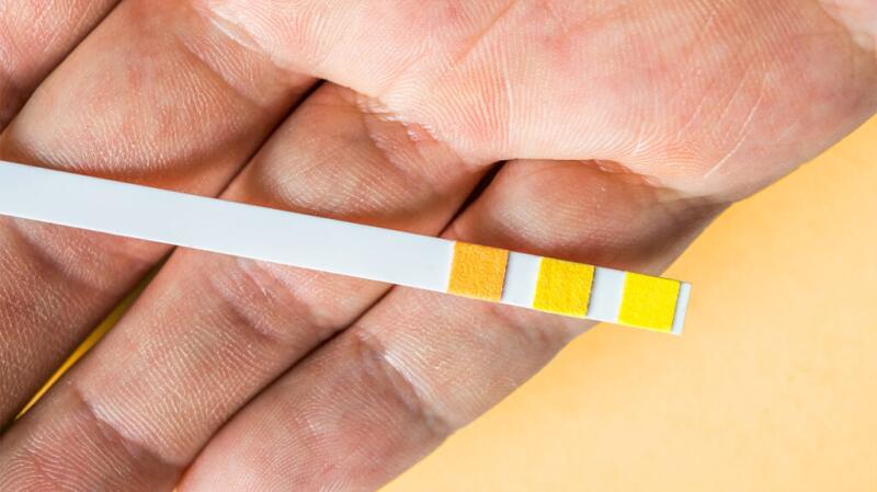 urine test strip in palm of hand