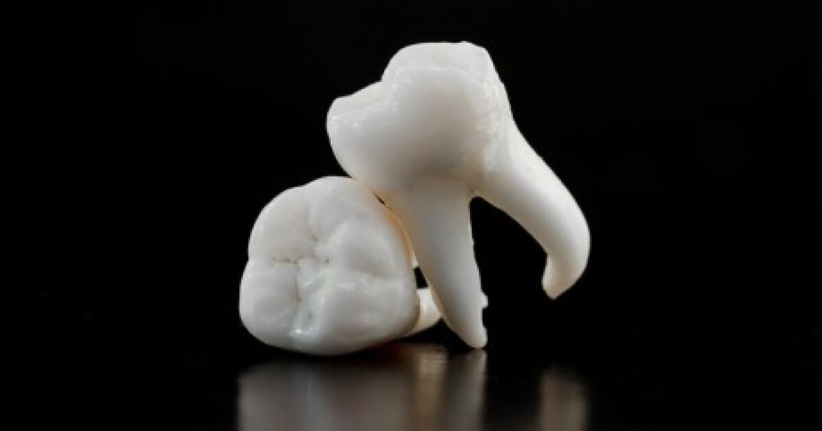 Tooth Extraction: Procedure Details, What to Expect