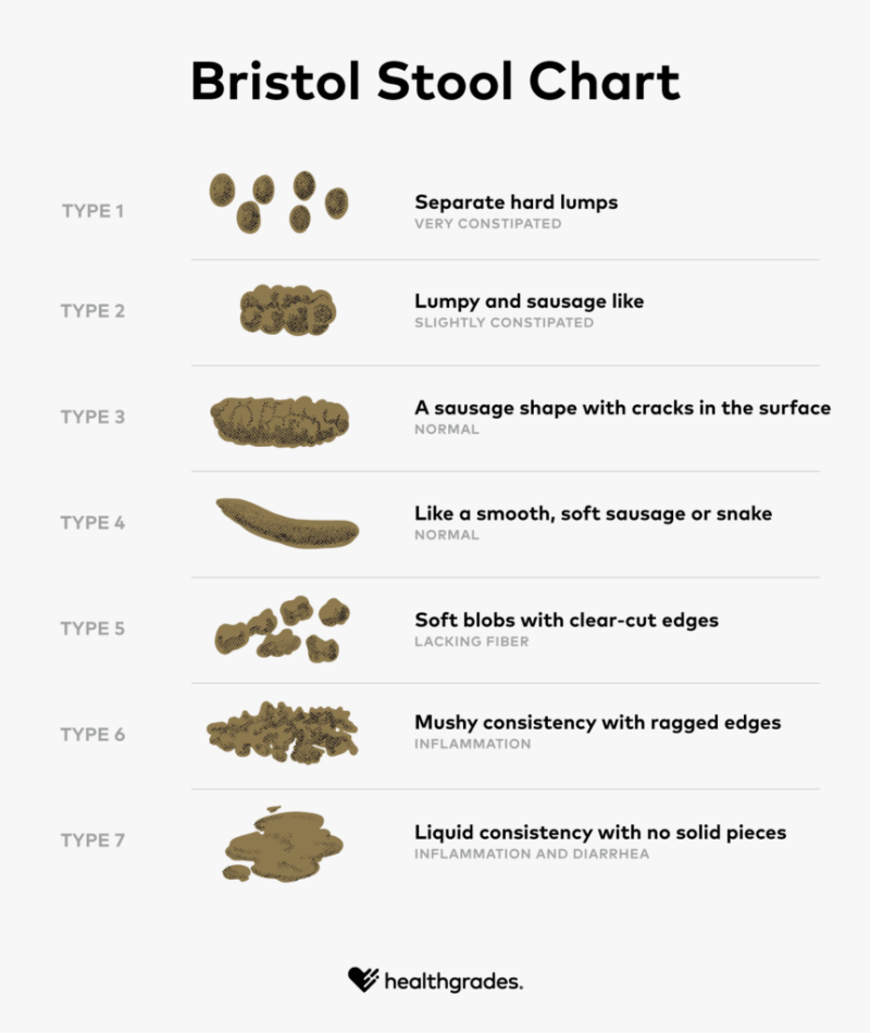 Doctors may use the Bristol Stool Chart to categorize stools according to their appearance