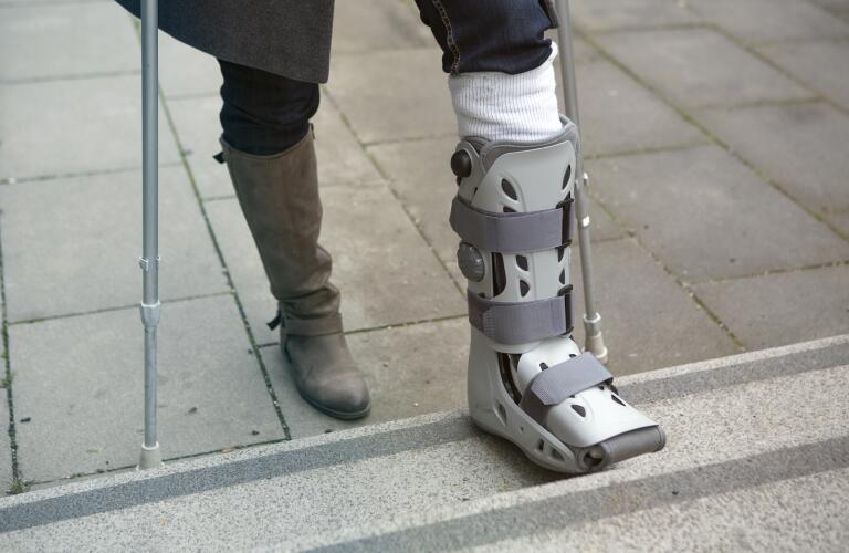 Woman with cast on foot