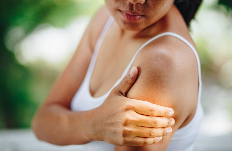 woman with rash on arm or shoulder