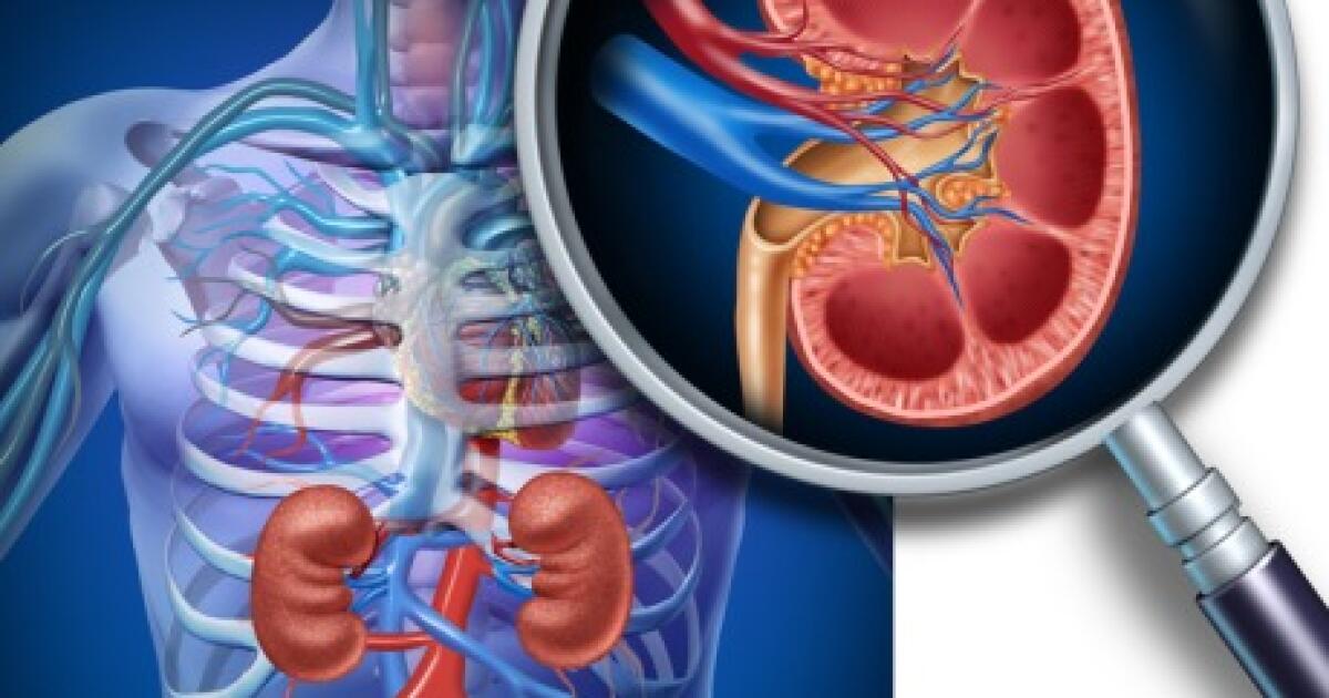 Nephrectomy Nephrectomy (Kidney Removal Surgery): Procedure Details, Risks, Recovery