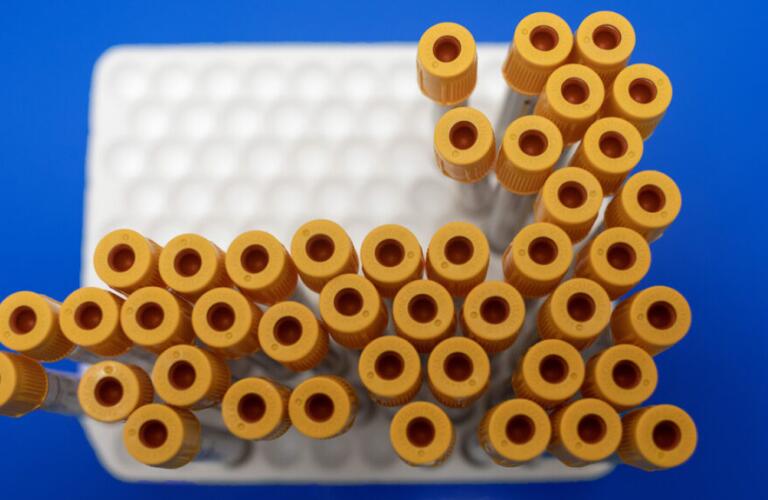 there are yellow blood tubes in a grid that look a little like white blood cells