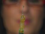 Botox Treatment
